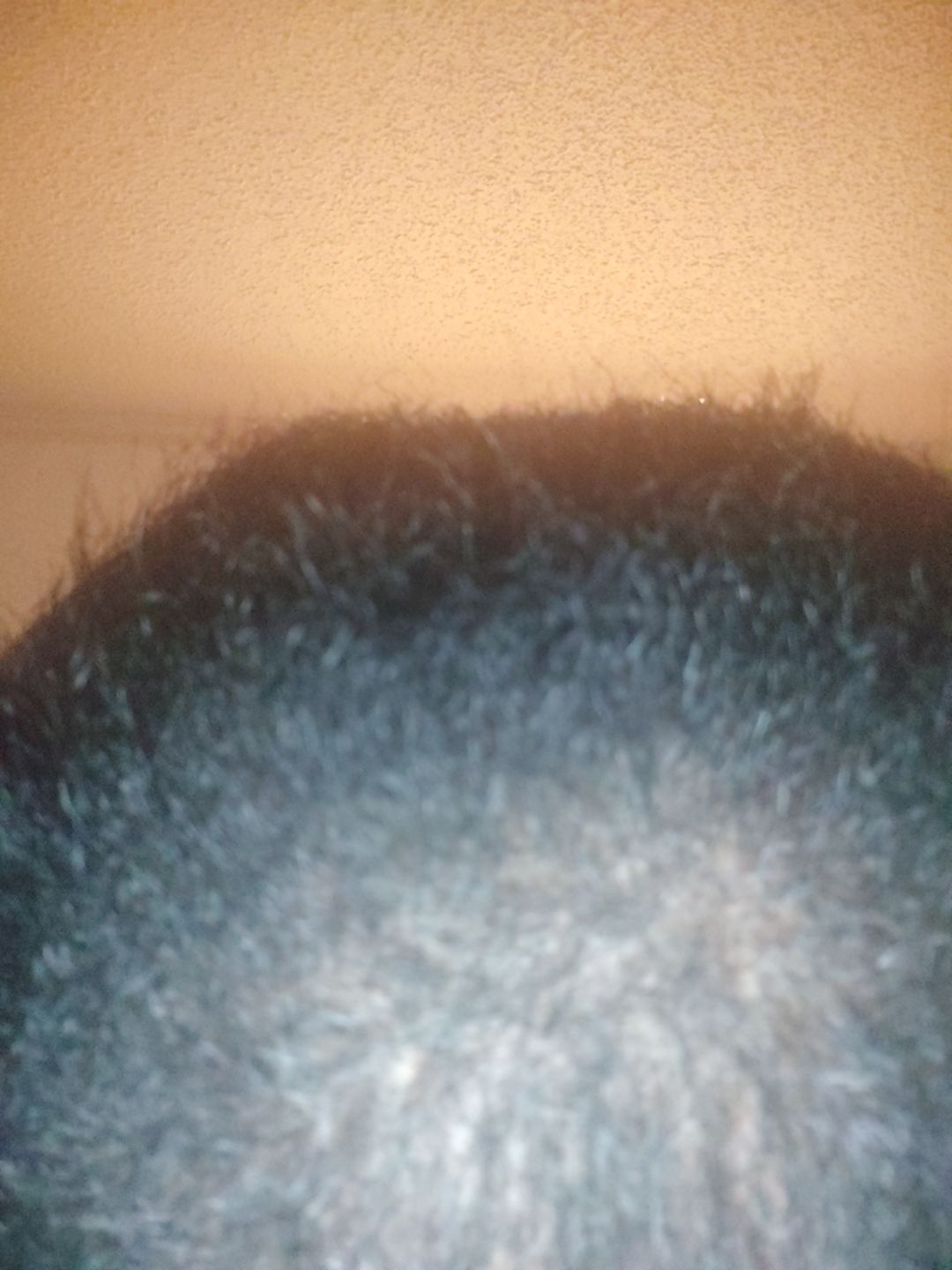 Customer photo review of Super G  Vital Growth Serum Water-based scalp serum infused with white willow bark