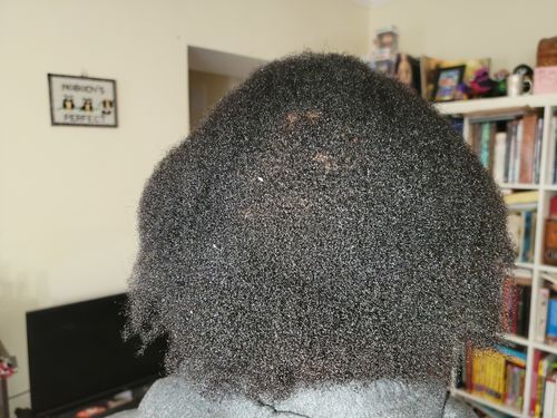 Customer photo review of India’s Secret Ancient Ayurvedic Hair Follicle Elixir (3 sizes)