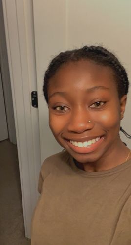 Customer photo review of TTDeye Donut Brown Colored Contact Lenses