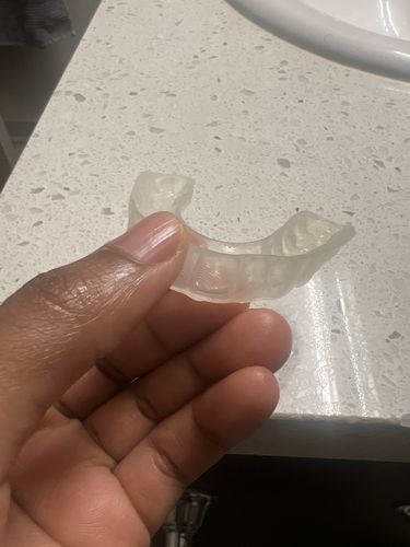 Customer photo review of Night Guard