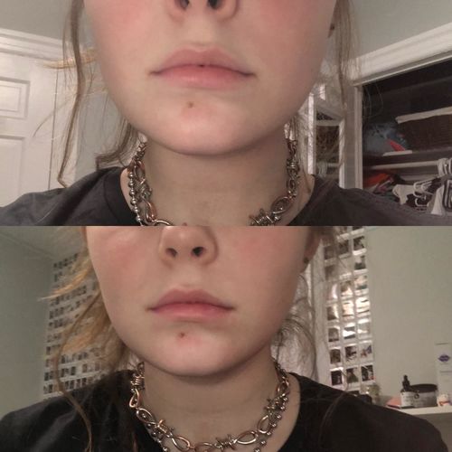 Customer photo review of SmalMask™