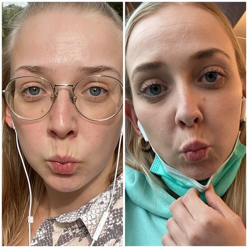 Customer photo review of HIGHLASH® Wimpern und Augenbrauen Serum