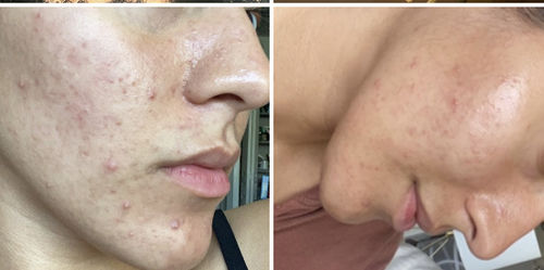 Brianna L. review of Qasil Powder for Hair and Skin, Organic Qasil Powder, Qasil Powder for Face, Pack of 1, 150gm image 1 out of 1