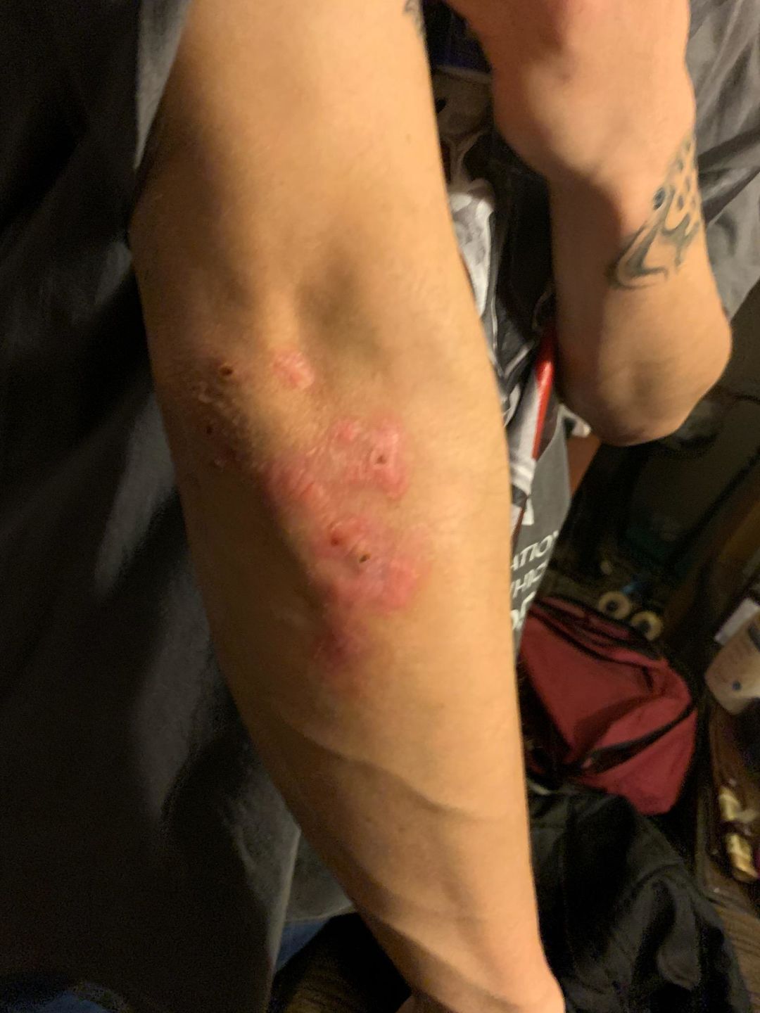 Customer photo review of Psoriasis Honey Scalp Nourishing Kit