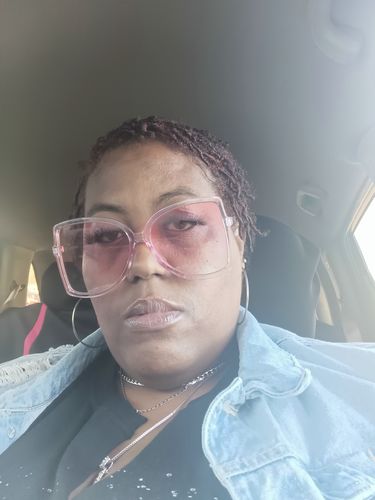 Customer photo review of Hair Growth Serum | 4 oz