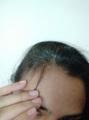 Customer photo review of Hair Growth / Anti-Loss Serum