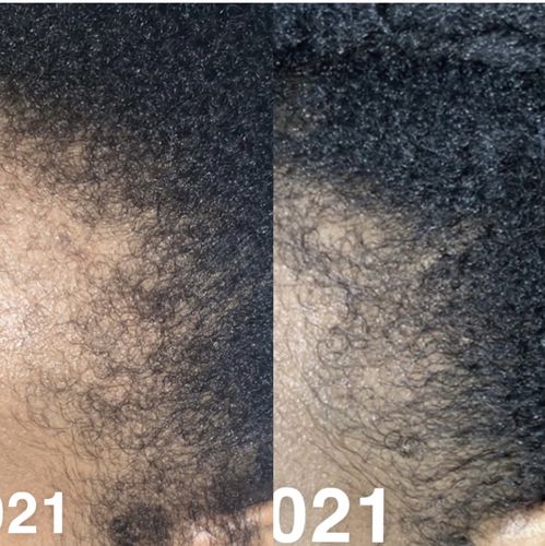 Customer photo review of Inches - Hair & Beard Oil
