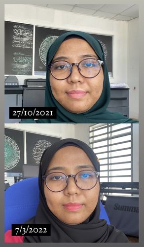 Customer photo review of Brightening Face Creme