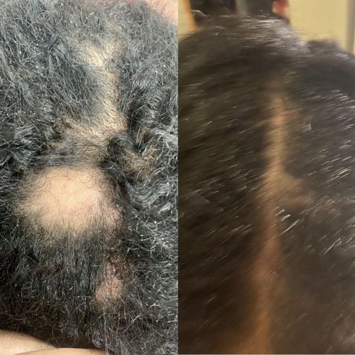 Customer photo review of Inches - Hair & Beard Oil