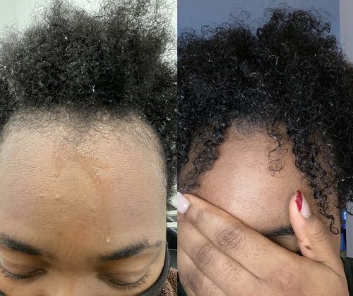 Customer photo review of Vine - Strengthening Protein Treatment Bar