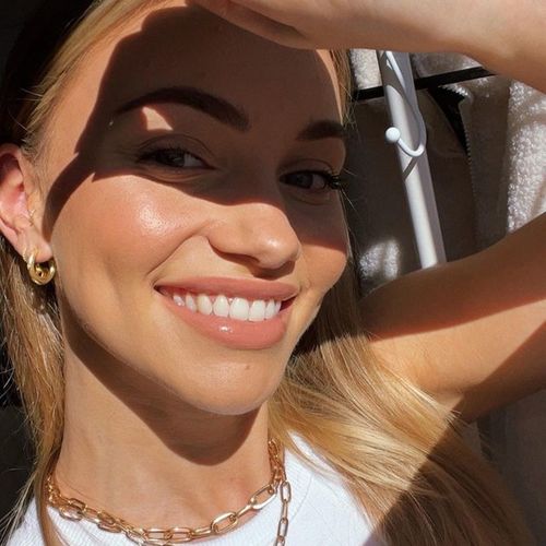 Customer photo review of Tooth-Veneer