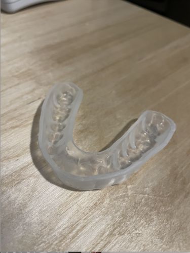 Customer photo review of Annual Plan – One night guard shipped every three months