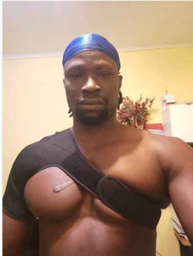 Customer photo review of Attelle ProtectPro®