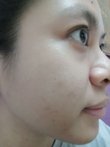 Customer photo review of Scar Repair Set