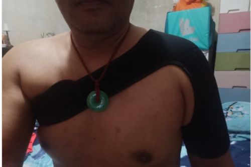 Customer photo review of Attelle ProtectPro®