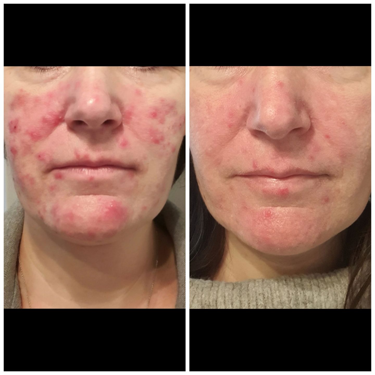Customer photo review of Good Clean - 3 mois