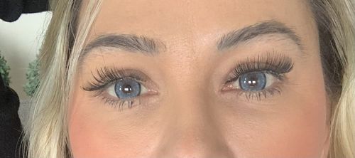 Customer photo review of Norko Blue Contact Lenses(12 months wear)
