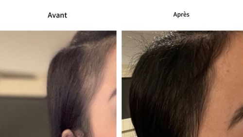 Customer photo review of Good Hair Vitamins - 1 mois