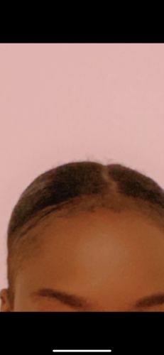 Customer photo review of Good Hair Vitamins - 1 mois