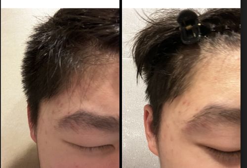 Customer photo review of Down Perm Kit