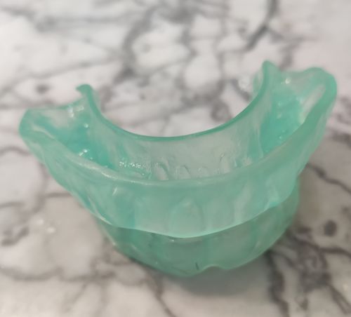 Customer photo review of SleepPro Custom AM