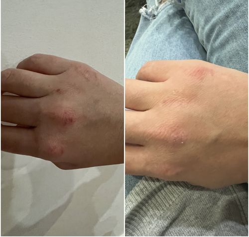 Customer photo review of Organic Barrier Balm