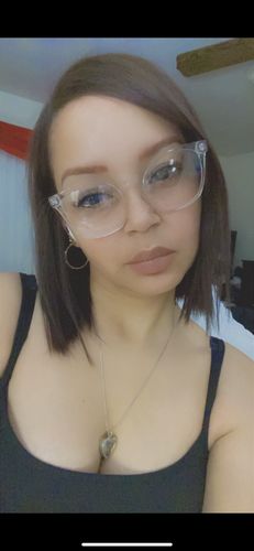Customer photo review of LipFix: LipFlip