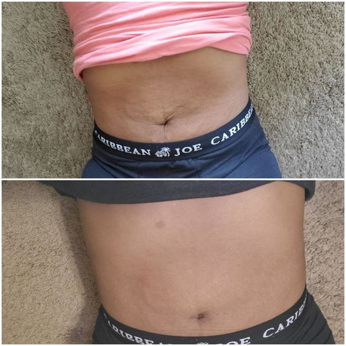 Customer photo review of Boldtique™ Magbantningskräm