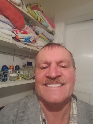 Customer photo review of Teeth-Veneer 2.0