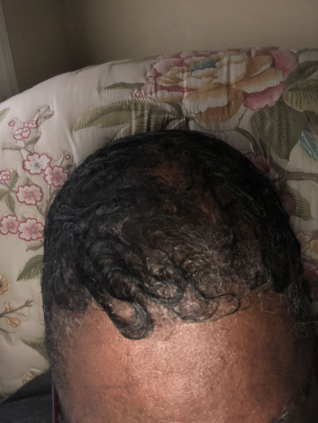 Customer photo review of Super G  Vital Growth Serum Water-based scalp serum infused with white willow bark