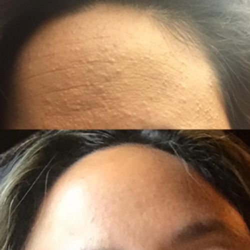 Customer photo review of PerfectionSerum™ Skin Rejuvination Serum