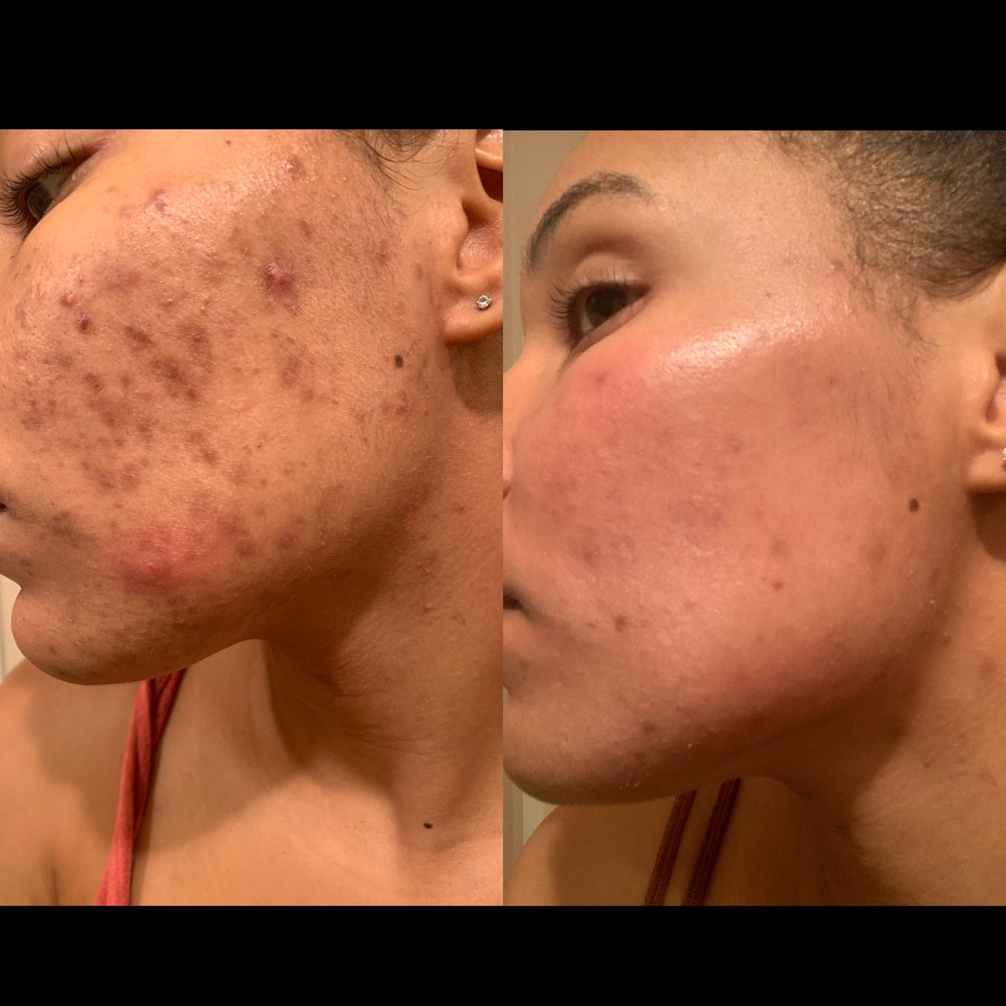 Customer photo review of PURIFYING FACE & BODY SCRUB