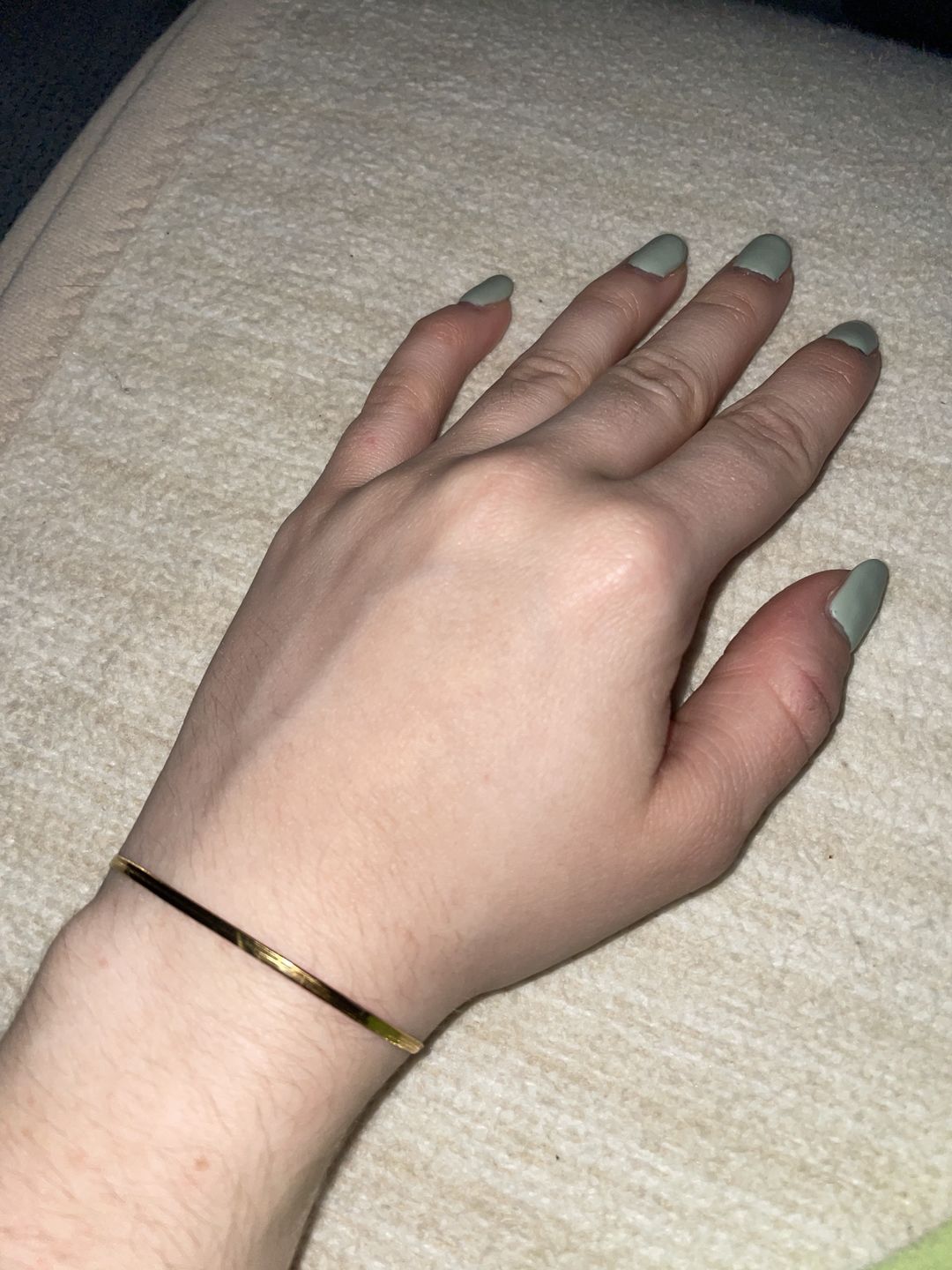 Customer photo review of Snake Skin Armband | 18K vergoldet
