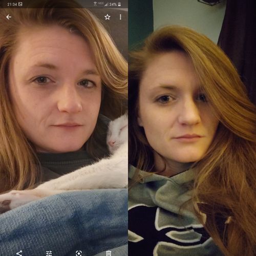 Customer photo review of AntiRynkor™ Fuktgivande Serum