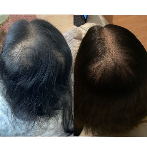 Customer photo review of Growth & Shine Hair Oil