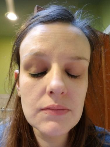 Customer photo review of Reusable Adhesive Eyelashes