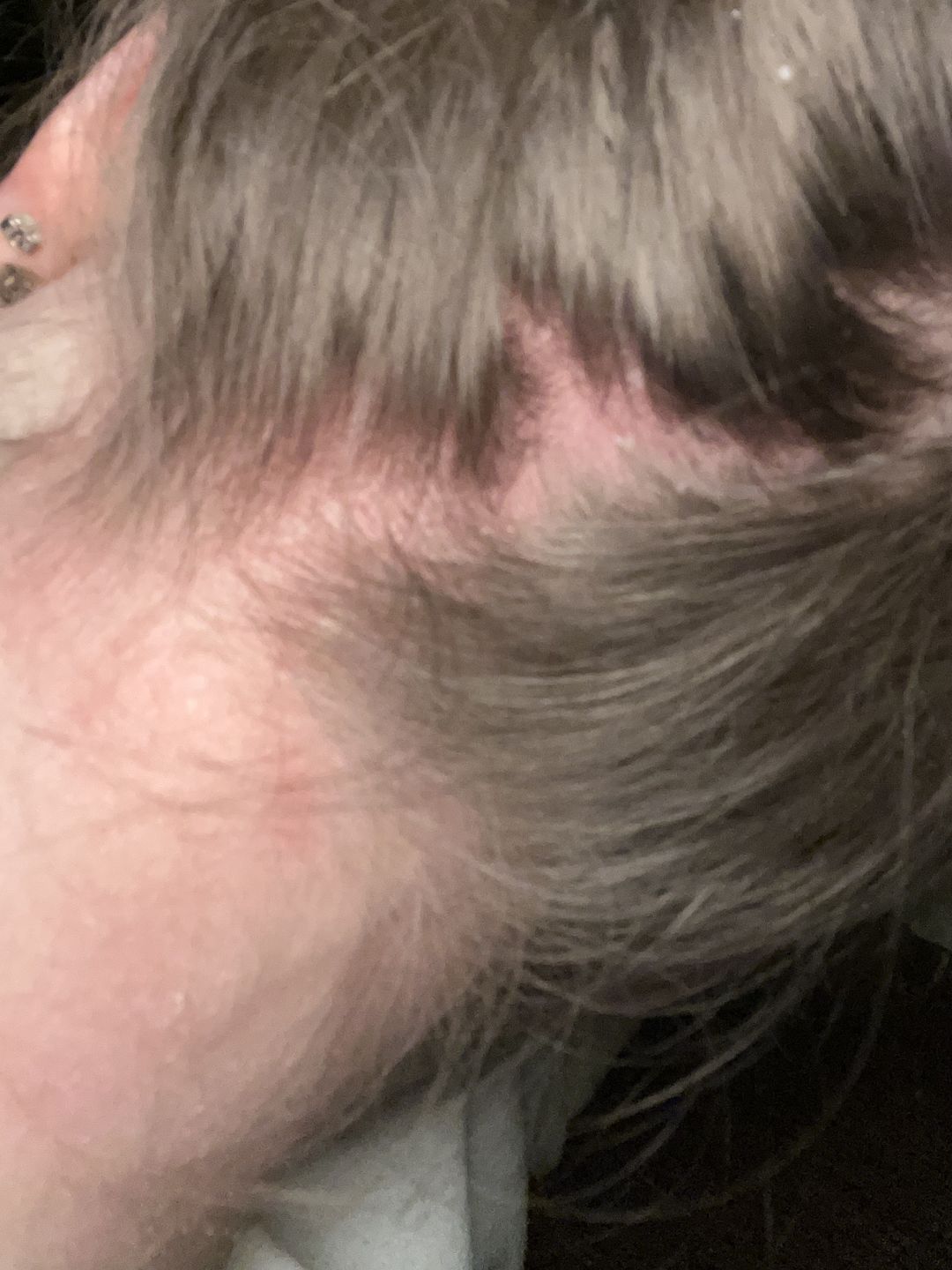 Customer photo review of Scalp Oil