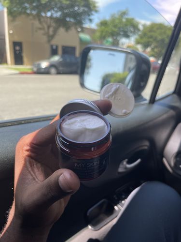 Customer photo review of My Skin and Co Skin Treatment Cream, Liquid, Men's, 2 Oz