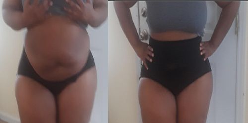 Customer photo review of PerfektForm™ Shapewear Magkontroll