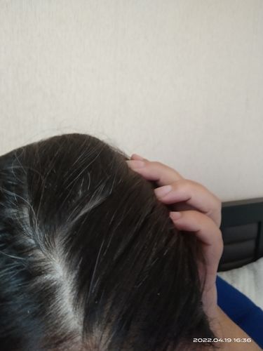 Customer photo review of SHAMPOO ANTICASPA FORMATO BARRA