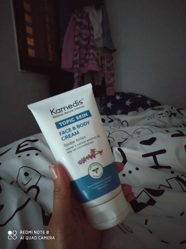 Customer photo review of קרם לחות טיפולי לעור יבש עד יבש במיוחד | TOPIC FACE & BODY CREAM