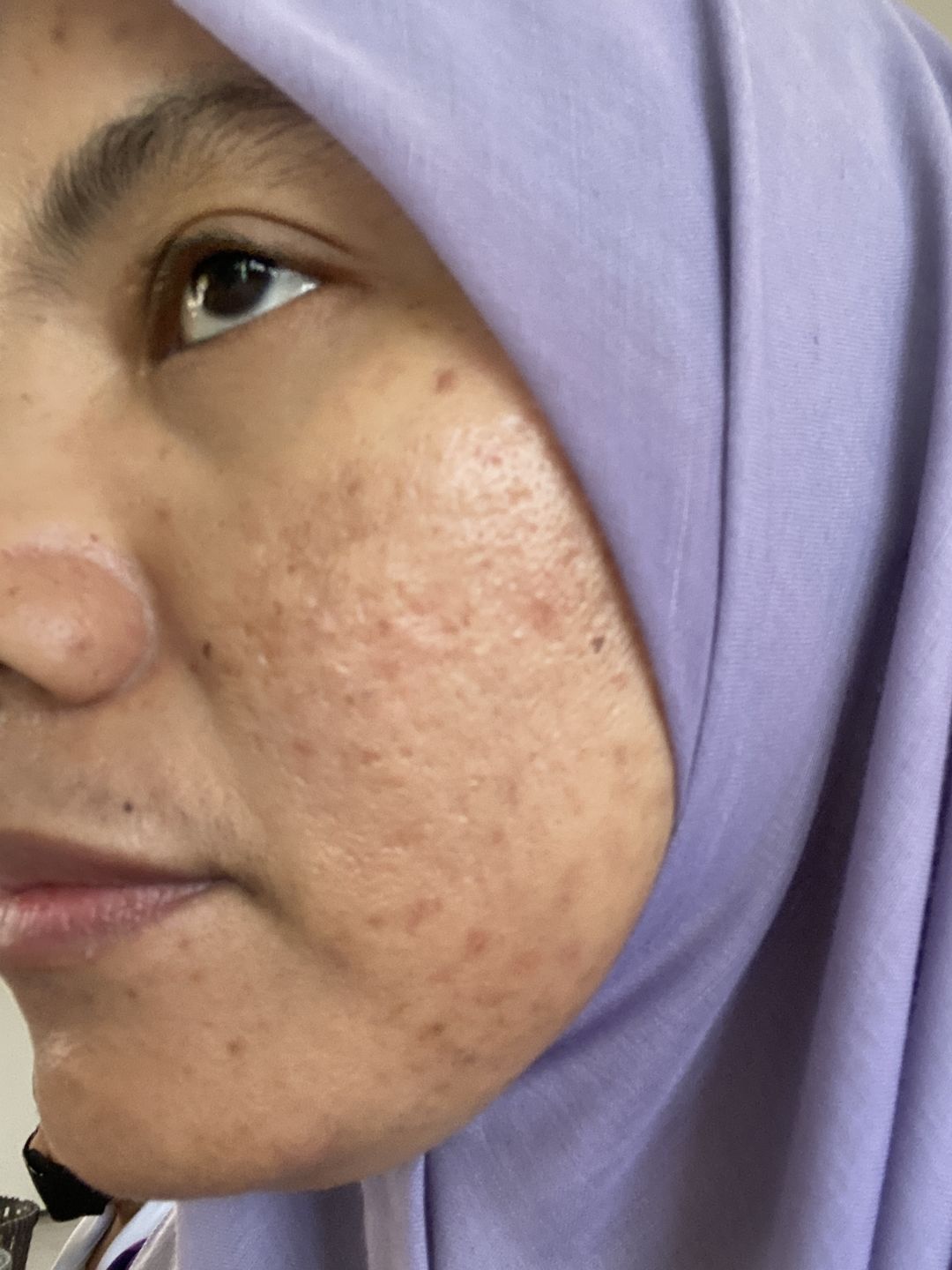 Customer photo review of Face Set