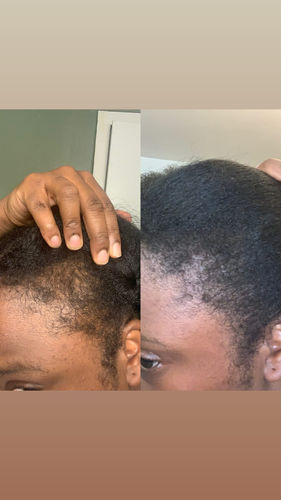 Customer photo review of Hair Growth Potion - Extra Strength