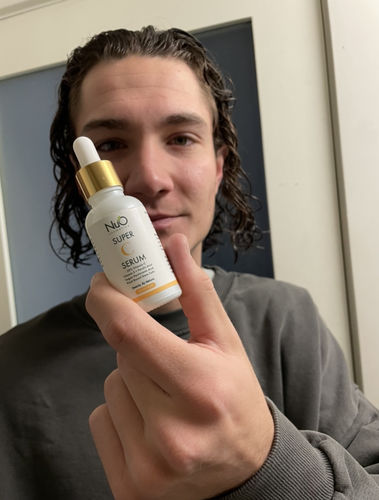 Customer photo review of Super C Serum