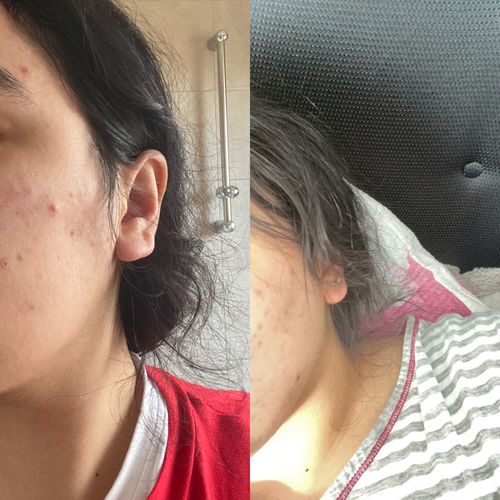 Customer photo review of GLOW DUOs