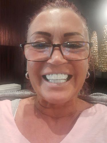 Customer photo review of Teeth-Veneer 2.0