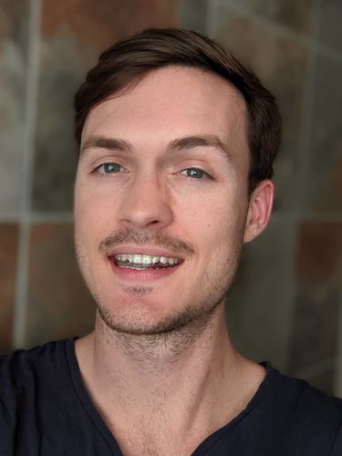 Customer photo review of Annual Plan – One night guard shipped every three months