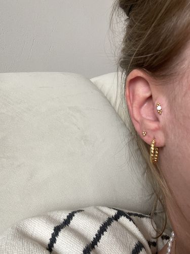 Customer photo review of Crystal Dots Labret Piercing