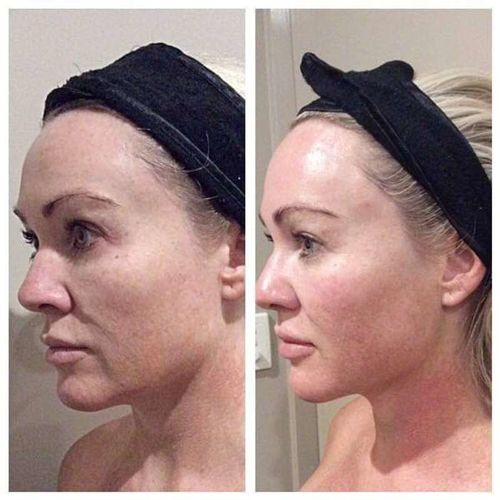 Customer photo review of Dermasoie Masque-Sérum Nuit Liftant