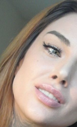 Customer photo review of Teeth-Veneer 2.0